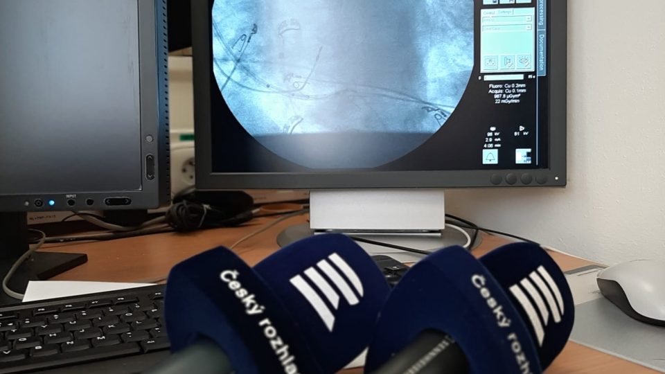 Český rozhlas Liberec živě vysílal z Kardiovaskulárního centra liberecké nemocnice, které paří k pěti nejlepším v ČR